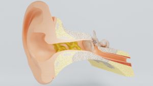 Ear wax in the ear